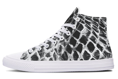 ANTIBrand Shedding Skin Snakeskin Effect Hightops